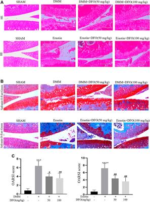 Deferoxamine Alleviates Osteoarthritis by Inhibiting Chondrocyte Ferroptosis and Activating the Nrf2 Pathway